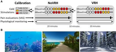 Virtual reality hypnosis diminishes experimental cold pain and alters autonomic responses